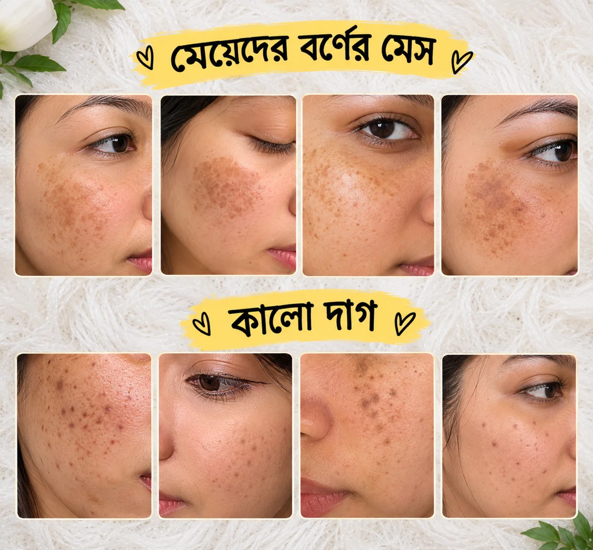 S.K.V Pearl & Curcumin Cream – স্কিন কেয়ার ক্রিম image 4